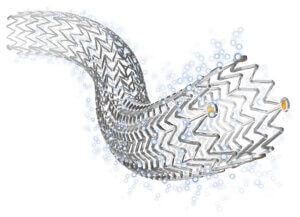 Zilver® PTX® with Thumbwheel enters into Chinese Mainland